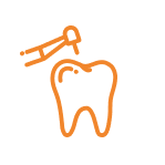 Composite Fillings